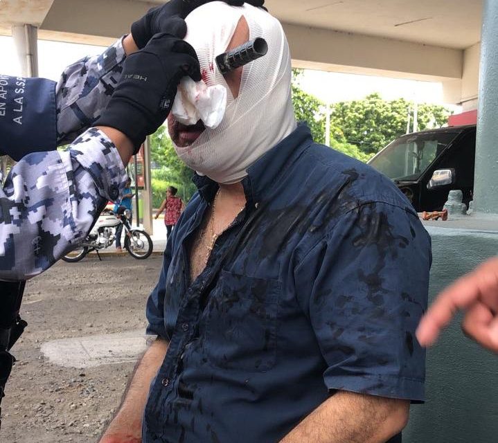 LE CLAVAN CUCHILLO EN LA CABEZA