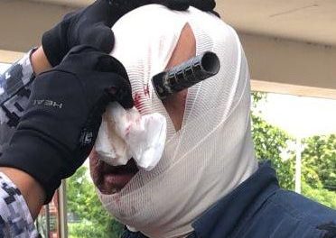 LE CLAVAN CUCHILLO EN LA CABEZA